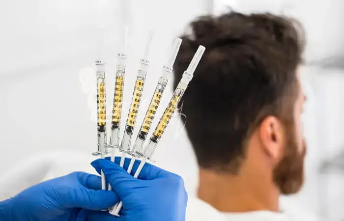 My experience with plasma injections for hair