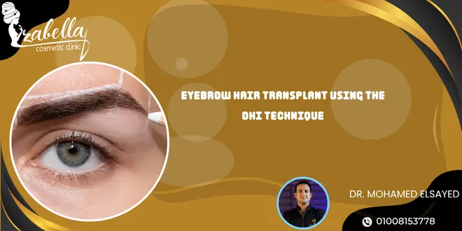 eyebrow hair transplant using the DHI technique