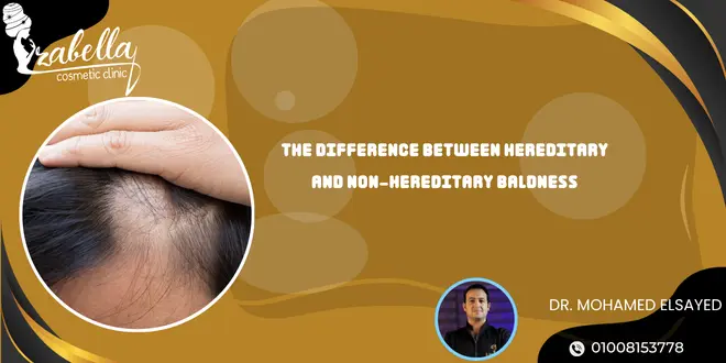 The difference between hereditary and non-hereditary baldness