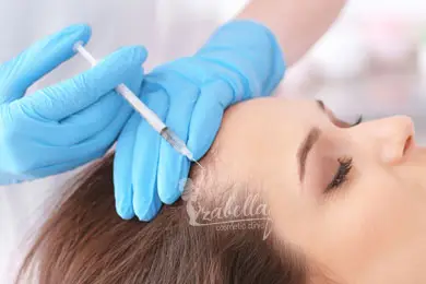 Hair transplant doctor for women