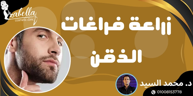 زراعة فراغات الذقن