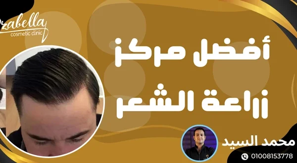 مركز زراعة شعر