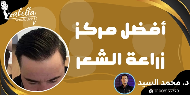مركز زراعة شعر