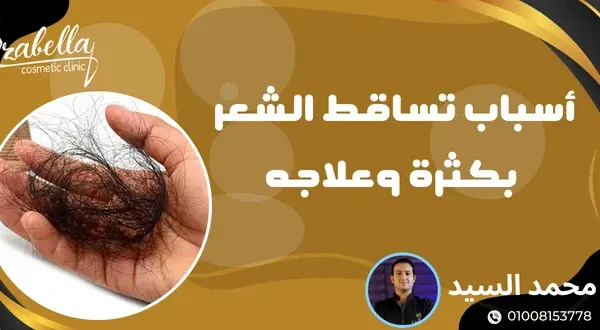 اسباب تساقط الشعر بكثرة