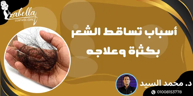 اسباب تساقط الشعر بكثرة