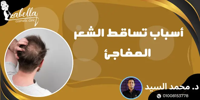 اسباب تساقط الشعر المفاجئ