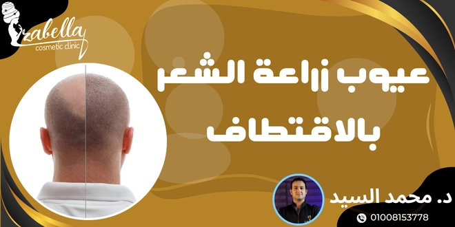 عيوب زراعة الشعر بالاقتطاف