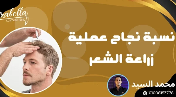 نسبة نجاح عملية زراعة الشعر