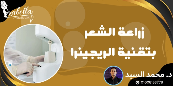 زراعة الشعر بالريجينيرا