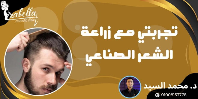 تجربتي مع زراعة الشعر الصناعي
