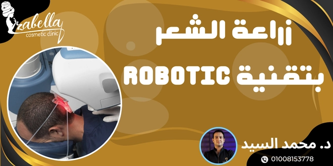 زراعة الشعر بتقنية Robotic