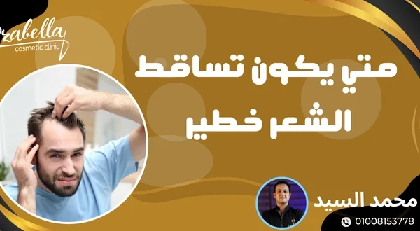متي يكون تساقط الشعر خطير