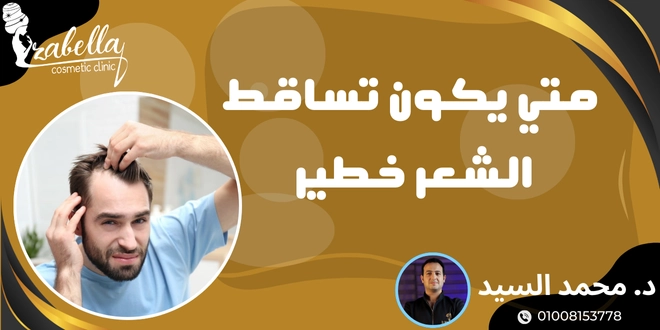 متي يكون تساقط الشعر خطير