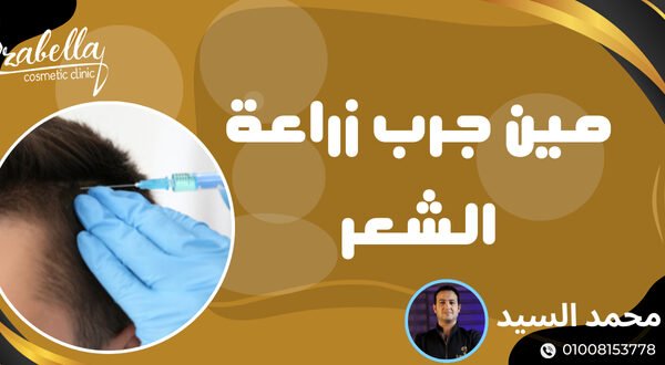 مين جرب زراعة الشعر في مصر