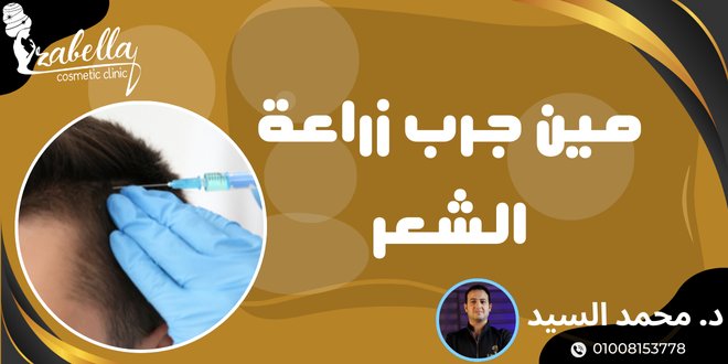 مين جرب زراعة الشعر في مصر