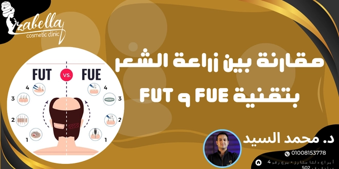 مقارنة بين زراعة الشعر بتقنية fue و fut