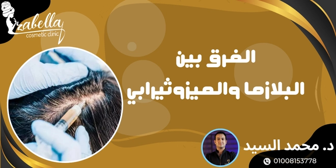 الفرق بين البلازما والميزوثيرابي للشعر